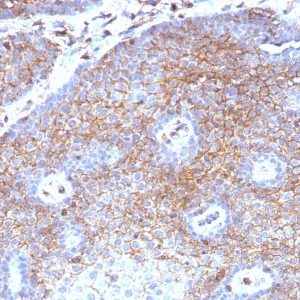 Monoclonal anti Beta 2 Microglobulin (B2M) (B2M/1118)