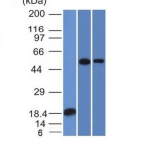 Monoclonal anti TOX3 (TOX3/1124)