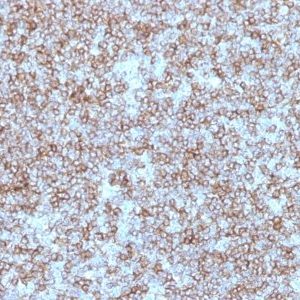 Monoclonal anti MHC II (HLA DP) (beta chain) (Bra 14)