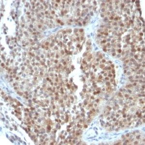 Monoclonal anti p21 / WAF1 (CIP1/823 + DCS 60.2)