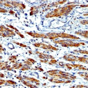 Monoclonal anti Myosin, Smooth Muscle Heavy Chain (MYH11/923 + SMMS 1)
