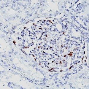 Monoclonal anti WT1 (Wilm's Tumor 1) (WT1/857 + 6F H2)