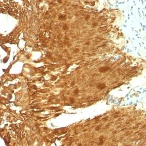 Monoclonal anti Cytokeratin 19 (KRT19/799 + KRT19/800)