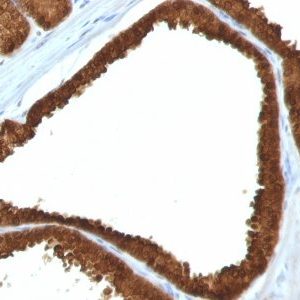 Monoclonal anti IDH1 (IDH1/1152)