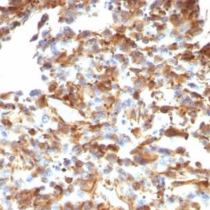 Monoclonal anti Vimentin (VM1170)