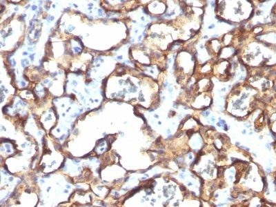 Monoclonal anti CD34 (HPCA1/1171)