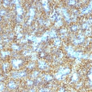 Monoclonal anti PTH / Parathyroid Hormone (N Terminal) (PTH/1174)