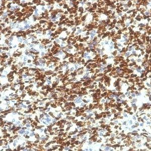 Monoclonal anti PAX7 (PAX7/1187)