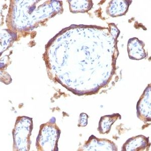 Monoclonal anti EGFR (GFR1195)