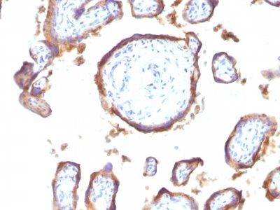 Monoclonal anti EGFR (GFR1195)