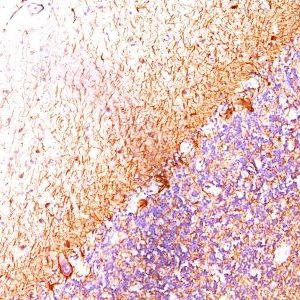 Monoclonal anti Neurofilament (H+L) (RT 97 + NR 4)