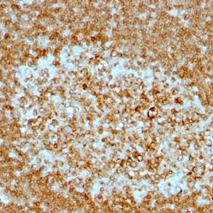 Monoclonal anti CD74 (LN 2 + CLIP/813)