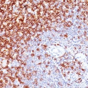 Monoclonal anti CD45RO (UCHL-1 + T200/797)