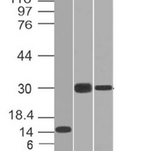 Monoclonal anti CELA3B (CELA3B/1218)