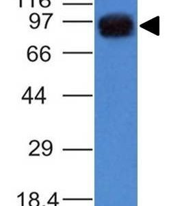 Monoclonal anti UACA / Nucling (UACA/1222)