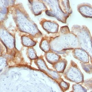 Monoclonal anti HCG beta (HCGb/54+ HCGb/459)