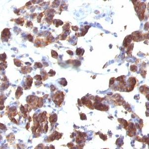 Monoclonal anti Thyroglobulin (TGB04 + TGB05)