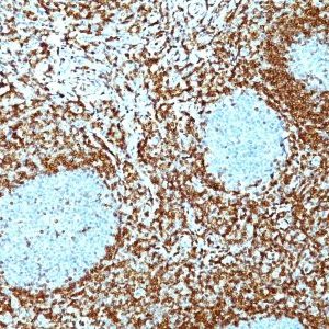 Monoclonal anti bcl 2 (100/D5 + 124)