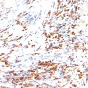 Monoclonal anti p27 / KIP1 (DCS 72.F6 + KIP1/769