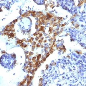 Monoclonal anti Napsin A (NAPSA/1239)