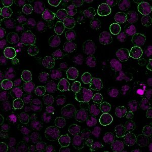 CD19 Monoclonal Mouse Antibody (CVID3/155)