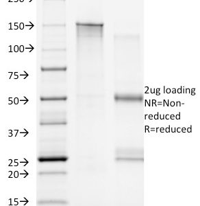 CD20 Monoclonal Mouse Antibody (B9E9)