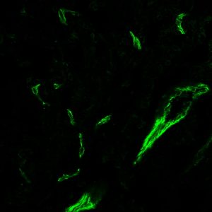 CD31 / PECAM-1 Monoclonal Mouse Antibody (C31.3 + C31.7 + C31.10)