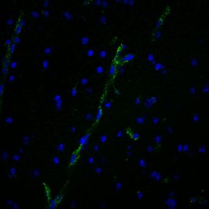 von Willebrand Factor / vWF Monoclonal Mouse Antibody (3E2D10)