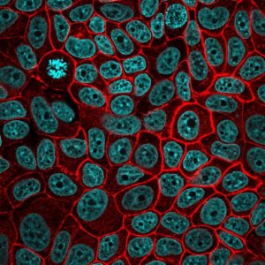 CF568 Ep-CAM EGP40/826 BNC680826