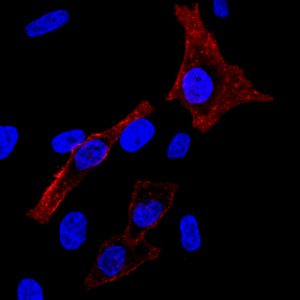 Cholera Toxin Subunit B CF® Dye Conjugates - Biotium