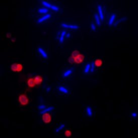 Microbiology Stain - E. coli and Salmonella co-culture stained with DAPI and CF633-WGA