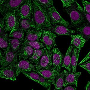 Cytokeratin 7 Monoclonal Mouse Antibody (OV-TL12/30)