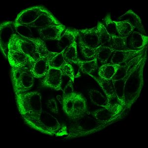Cytokeratin, Multi Monoclonal Mouse Antibody (C11)