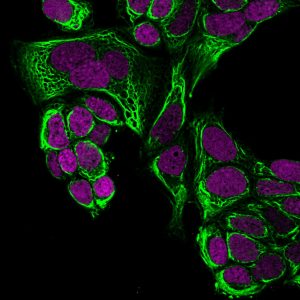 BNC880041 CF488A Cytokeratin 18 C-04 RedDot2
