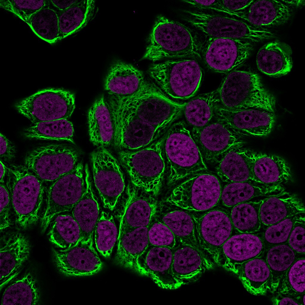 Ihc On Control Renal Tissue Cytokeratin Ck Staining A C Showing Download Scientific Diagram