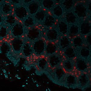 Eosinophil Peroxidase Monoclonal Mouse Antibody (AHE-1)