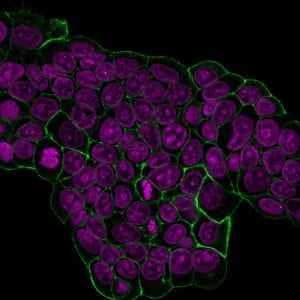 HER-2 / CD340 Monoclonal Mouse Antibody (HRB2/451)