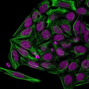Cytokeratin 7 Monoclonal Mouse Antibody (KRT7/1198)