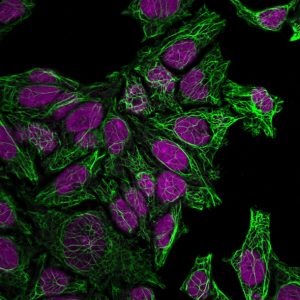 Cytokeratin 7 Monoclonal Mouse Antibody (KRT7/760)