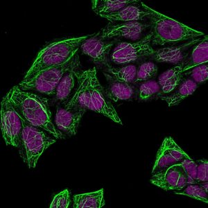 Cytokeratin 7 Monoclonal Mouse Antibody (KRT7/760 + OV-TL12/30)