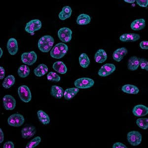 Nucleolin Monoclonal Mouse Antibody (364-5 + NCL/902)