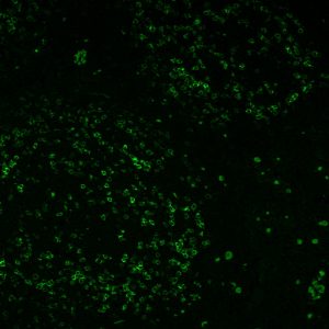 PD1 / PDCD1 / CD279 Monoclonal Mouse Antibody (PDCD1/922)