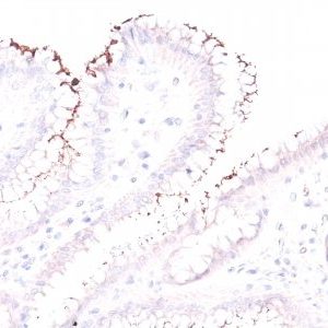 Polyclonal anti Helicobacter pylori (Rabbit PAb)