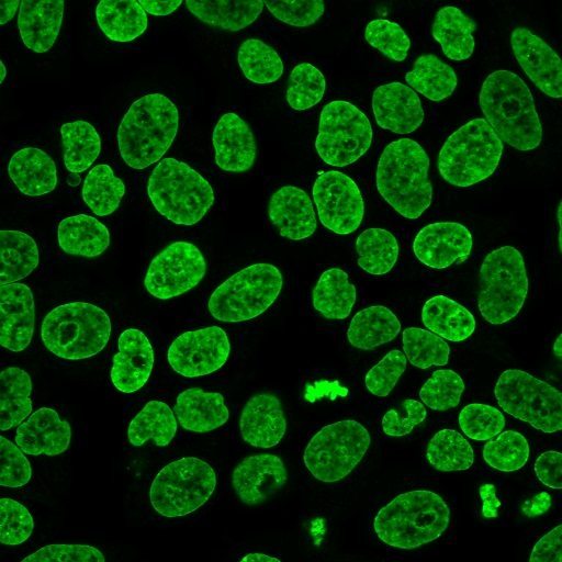 Fluorescent Cell Stains for Organelles & Cellular Structures | Biotium