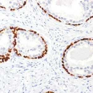 p63 Polyclonal Rabbit Antibody
