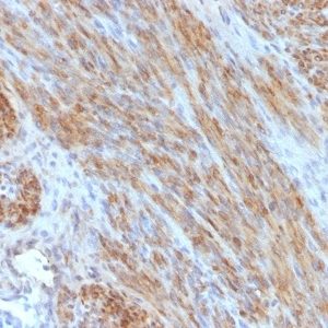 Desmin Monoclonal Mouse Antibody (DES/1711)