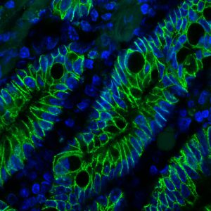 Ep-CAM / CD326 Monoclonal Mouse Antibody (EGP40/1372)