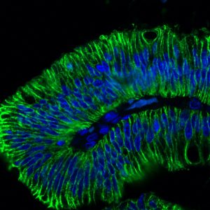 BNUB1798 Ep-CAM EGP40/798 CF488A goat anti-mouse