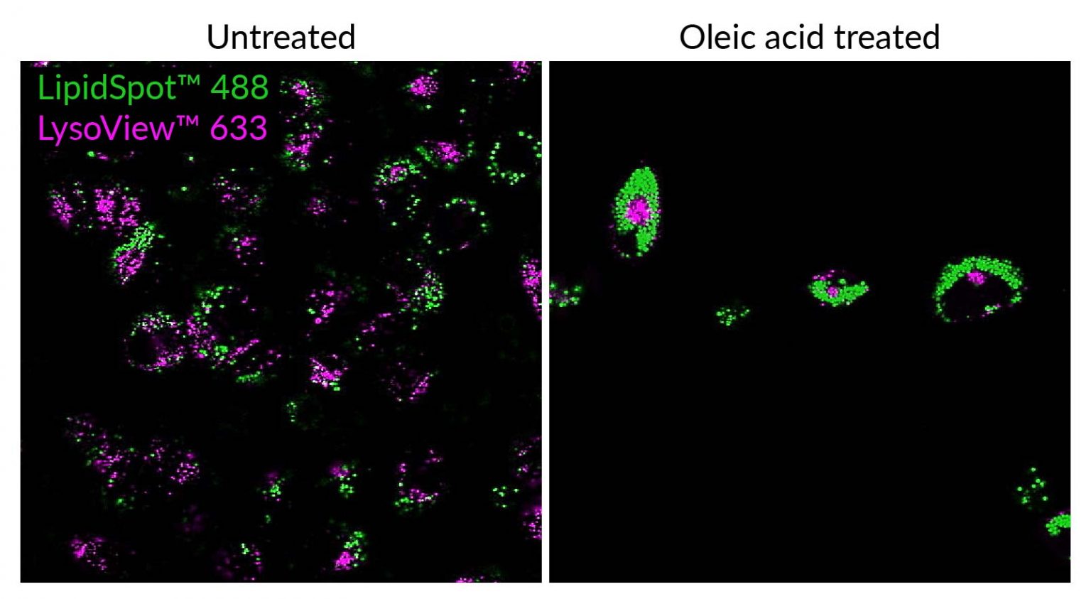 Lipidspot™ Lipid Droplet Stains Biotium