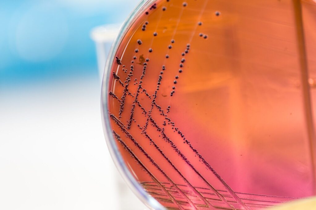 Switching from agar plates to vPCR for bacteria viability testing